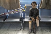 9 year old Salah al Wahbel who lost his lower left leg when he stood on a anti personel mine near his home in Yemen when he was playing with his friends and his brother. He is pictured as he waits for an appointment with his prosthetist at a hospital in Marib, Yemen.
Over 377,000 people have died as a result of the conflict in Yemen since 2015 of these 10,200 children have been killed or seriously injured. Over 4 million people mainly women & children have been forced to flee their homes due to the fighting. Many have gone to neighbouring countries but many more live in spartan and difficult conditions in make shift refugee camps. Houthi rebels have forcibly recruited 10,300 children aged 10 yrs and above to fight in the conflict. Testimonies from former boy soldiers tell of harsh treatments & severe punishments including violent assaults and imprisonments with some being sexually assaulted. In 2020 alone 1,500 child soldiers were killed in battles. There is currently a cease fire in the conflict.
Photograph:Philip Coburn