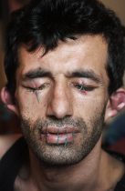 Abas Amini who is an asylum seeker from Iran who has sewn up his mouth, eyes and ears in protest at his treatment from the home office. Abas is living in Nottingham.
Pa Photo by Fabio De Paola